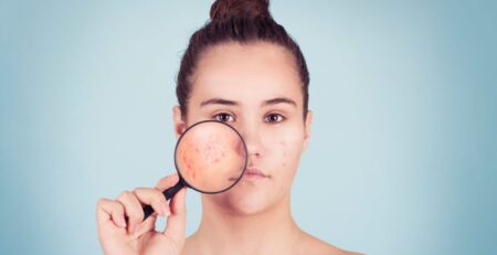 Reasons Why Probiotic Serum Is The Next Big Thing In Acne Treatment