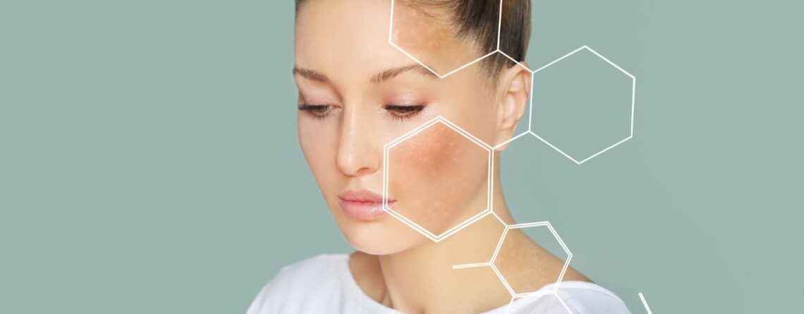 5 Surprising Benefits Of Acerola Cherry For Skin Whitening